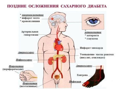 Снижает ли имбирь сахар в крови: полезные свойства корня, его польза и вред при диабете 1 и 2 типа, а также можно ли или нет есть маринованный, как принимать?